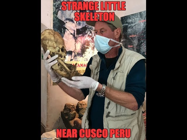 Strange Elongated Skull Skeleton In Peru  Sddefault