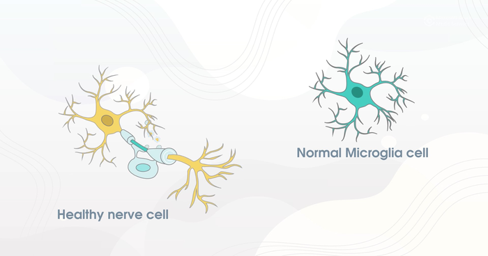 Study finds hydroxychloroquine delays disability for least treatable form of multiple sclerosis