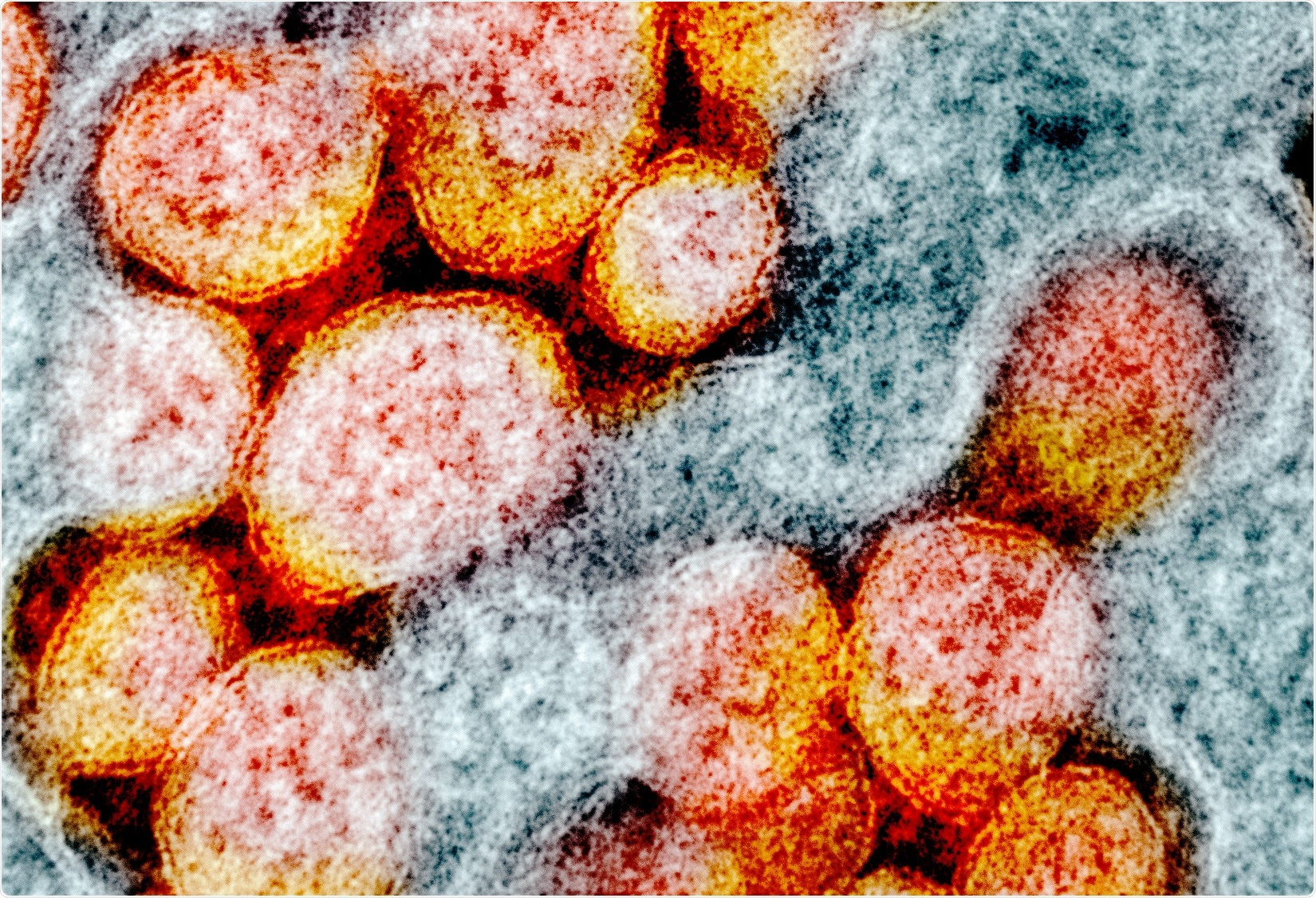 Study: The SARS-CoV-2 spike reversibly samples an open-trimer conformation exposing novel epitopes. Image Credit: NIAID