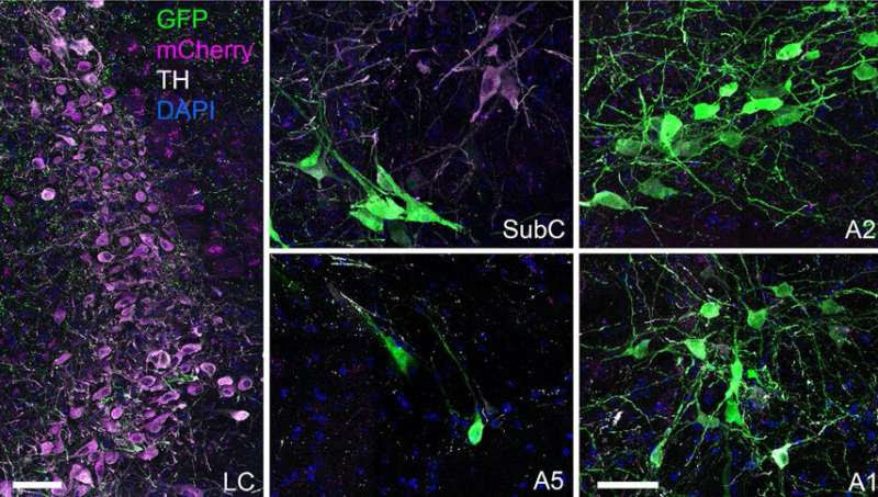 Scientists detail brain dynamics implicated in neurological conditions