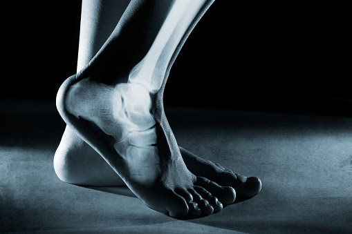 imagen de pies al estilo de una radiografia