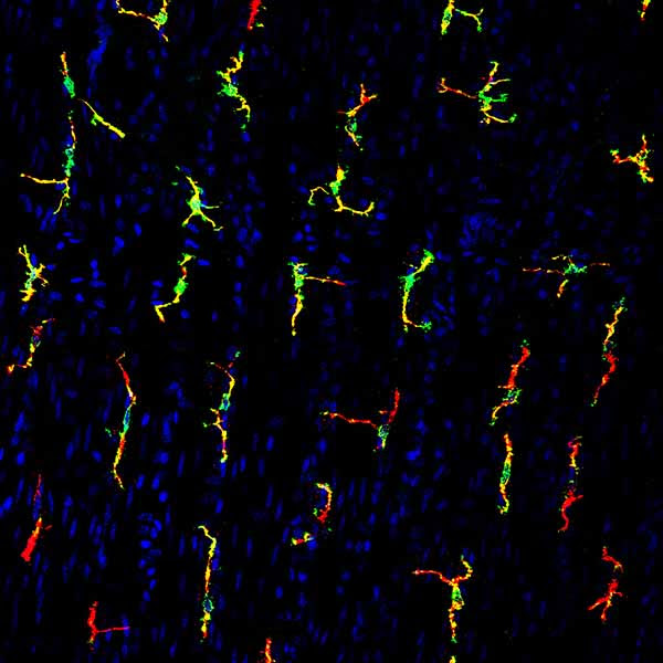 receptor on immune cells called macrophages