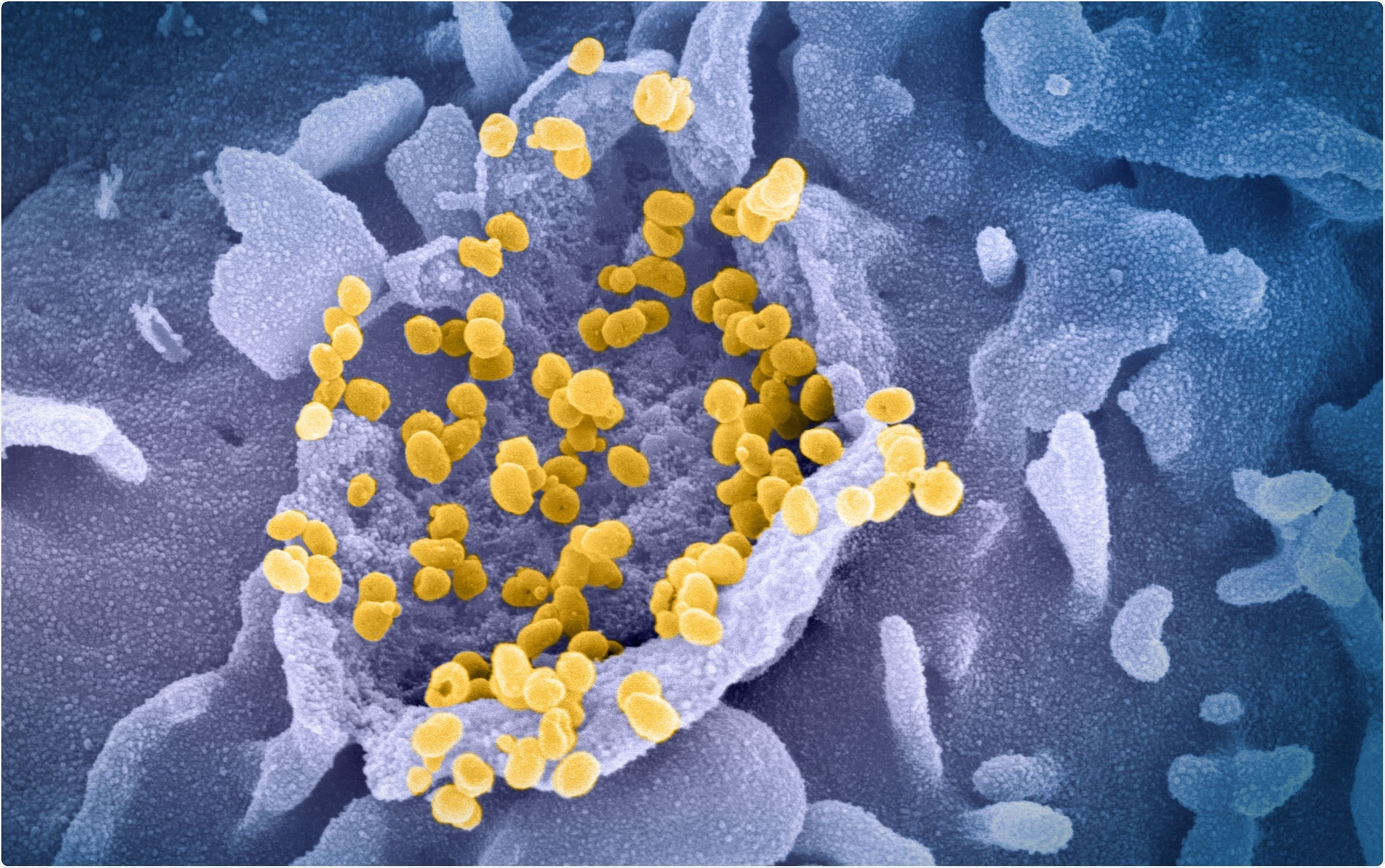 Study: First identification of SARS-CoV-2 Lambda (C.37) variant in Southern Brazil. Image Credit: NIAID