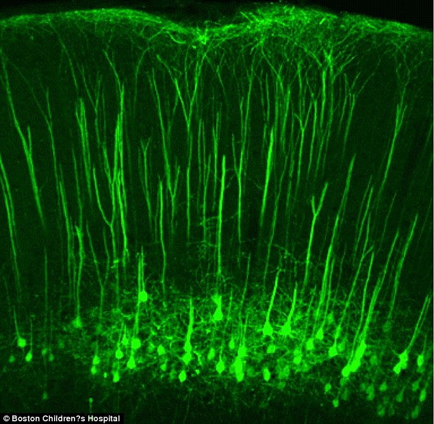 Scientists discovered this group of neurons, which descends from a center for sensory information in the brain to the spinal cord, where 'touch' gets mistakenly translated into 'pain'