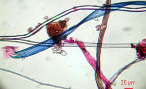 Imagen de microfibras encontradas en el medio marino.