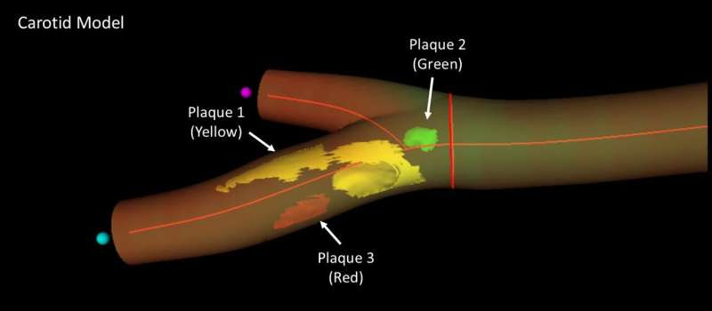 3D matrix ultrasound accurately identifies cardiovascular injury in healthy individuals