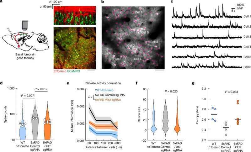 Swelling along brain's axons may be true culprit in Alzheimer's disease