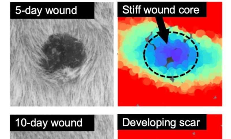 Researchers deconstruct tissue repair