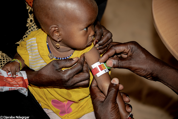 Mediante el uso de un brazalete MUAC, determinamos si un bebé sufre desnutrición.  