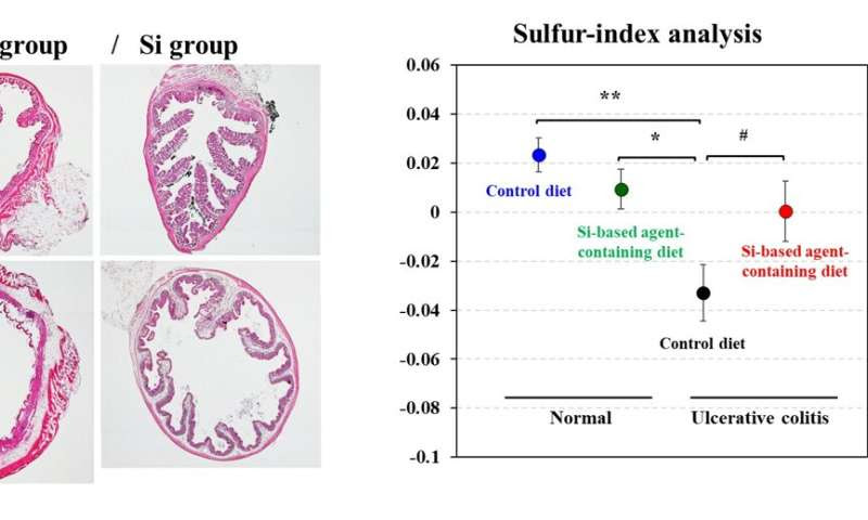 Hydrogen generated by Si-based agent attenuates inflammation in ulcerative colitis mouse model