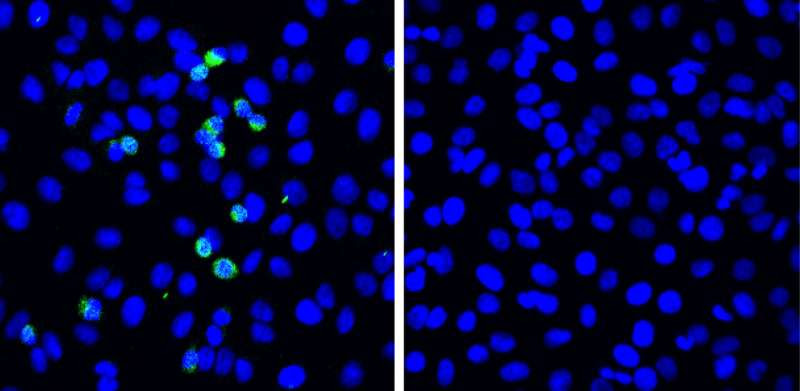 A novel defense mechanism for SARS-CoV-2 discovered