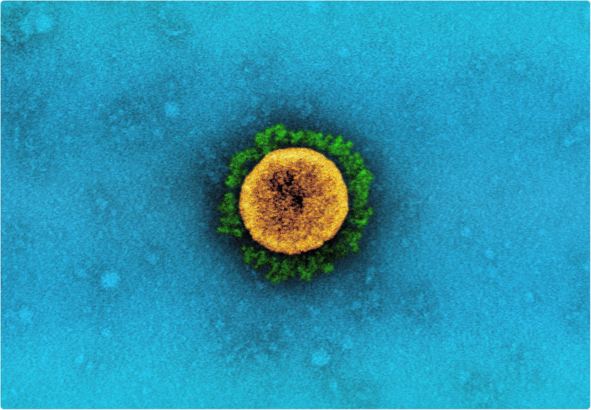 Study: Epidemiological characteristics of the B.1.526 SARS-CoV-2 variant. Image Credit: NIAID