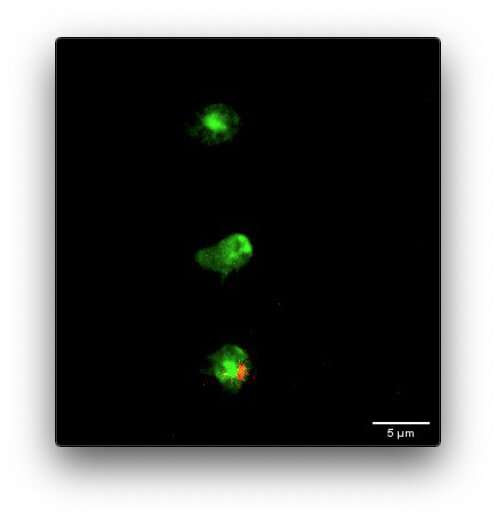 Monash University study uncovers a new understanding of how mesenchymal stromal cells benefit patients in cell therapy