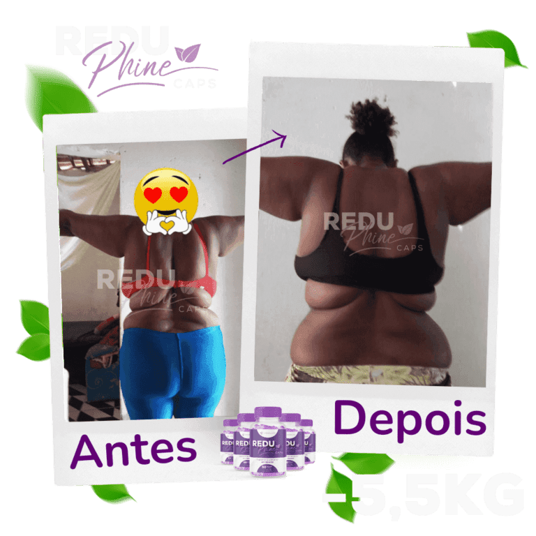 Reduphine Caps funciona