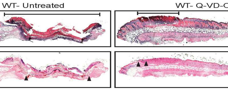 'Fortunate accident' may yield immunity weapon against antibiotic-resistant bacteria