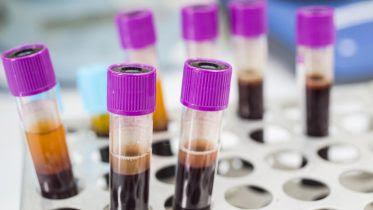 Blood Diagnostic Test Tubes