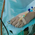 Someten a eutanasia por primera vez a enfermo no terminal en Colombia