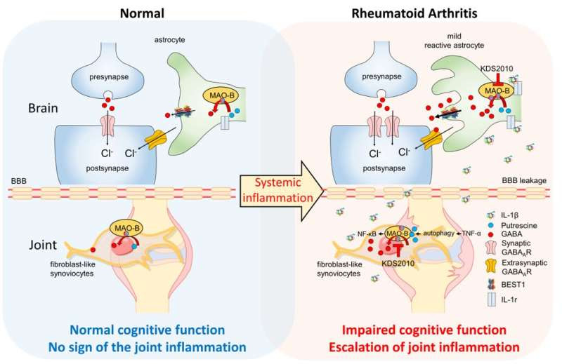 Two birds one stone strategy to treat both joint pain and cognitive impairment in rheumatoid arthritis