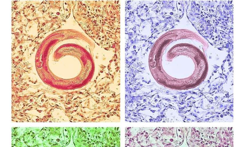 A common dietary fiber promotes allergy-like immune responses in preclinical studies