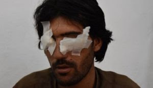 Ramadan in Pakistan: Man’s father and brother gouge out his eyes for “violating Islamic values”