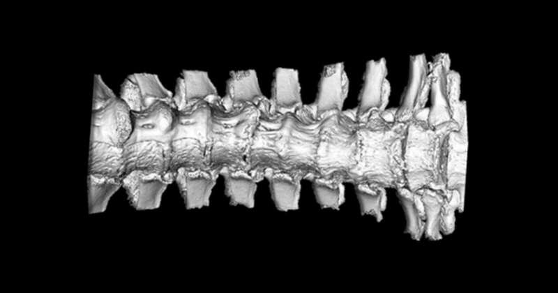 New research sheds light on symptoms of understudied spine disease