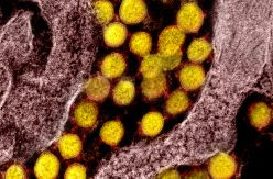 Las bacterias, 'personajes secundarios' que aprovechan la oportunidad para atacar en enfermos de COVID-19