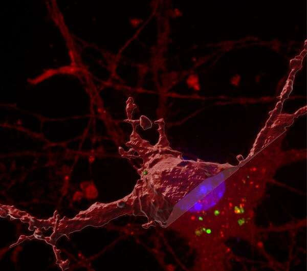 New discovery for how the brain ‘tangles’ in Alzheimer’s disease