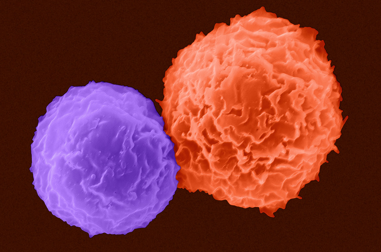 colored scanning electron micrograph of a helper T cell and B cell