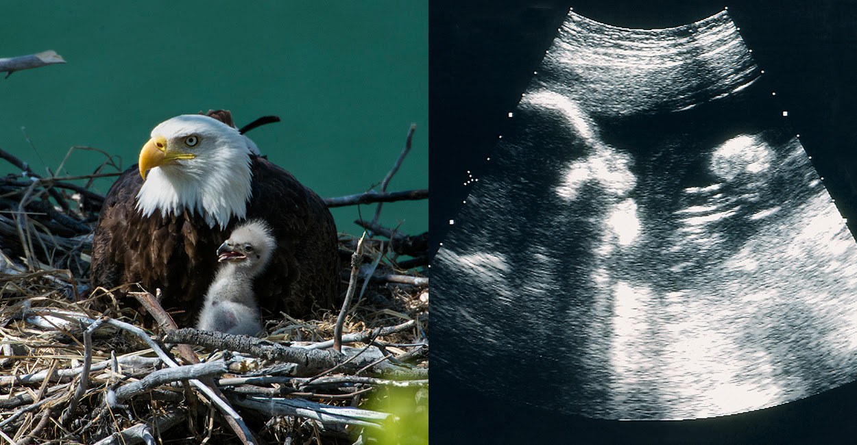 In at Least 6 States, Endangered Animals Enjoy More Protections Than Unborn Babies