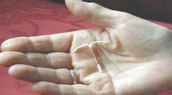 IUD-e1517542975339.jpg IUD-e1517542975339.jpg