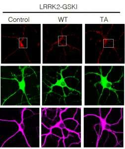 Researchers show how protein clogs in cellular entrances cause Parkinson’s disease