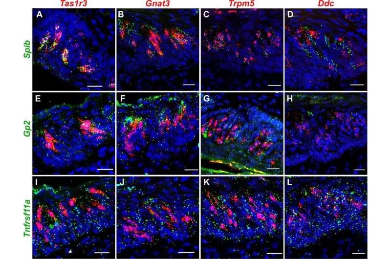 Taste cells' role in immune response may lead to treatment of taste loss