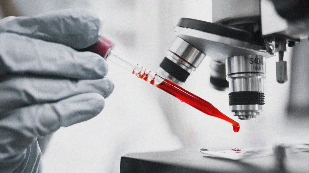 A lab technician placing blood under a microscope to check a person's complete blood count (CBC).