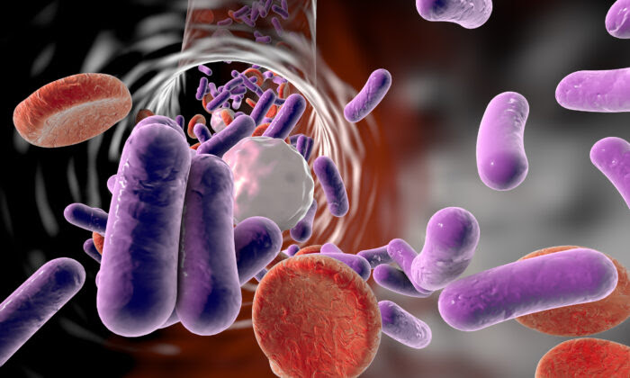 Sepsis Still Kills 1 in 5 People Worldwide: Be Aware of the Red Flags (Video)