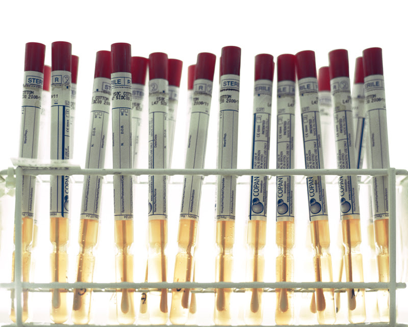 dna specimens DNA specimens