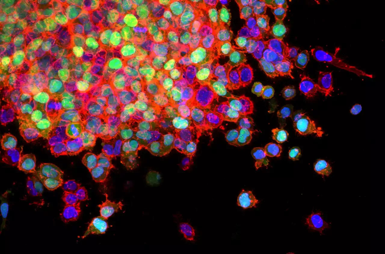 Glowing tumor marker may interfere with cancer studies in mice, creating reproducibility problems