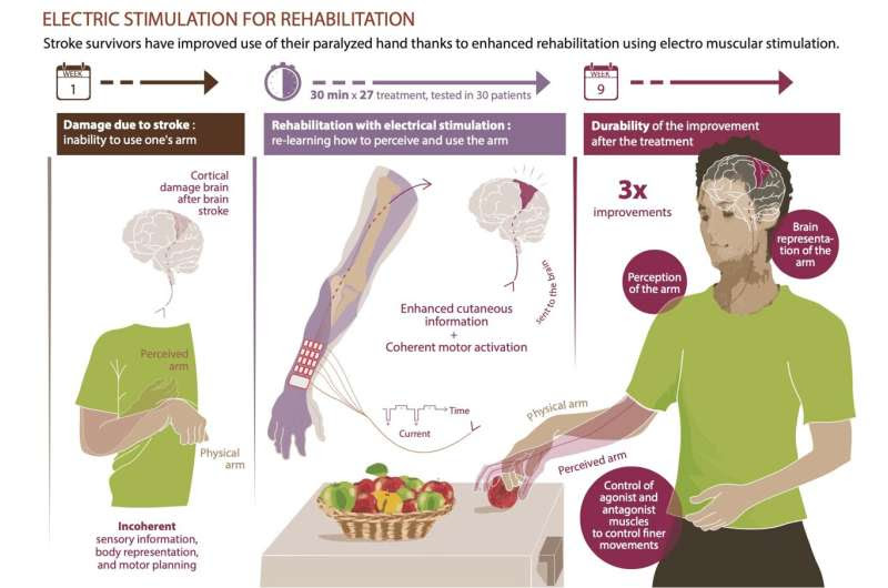 Improved motor, sensory, and cognitive recovery of hand and arm function after stroke