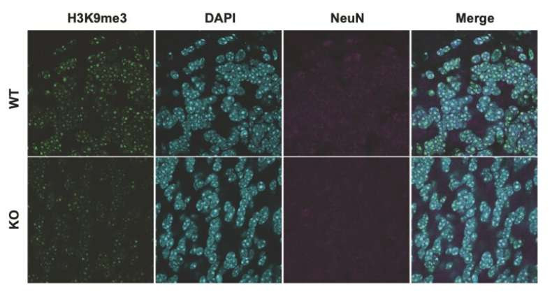 SUV39H2: A direct genetic link to autism spectrum disorders