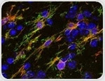 Tools for Detecting Neuroinflammation in Neurodegenerative Diseases