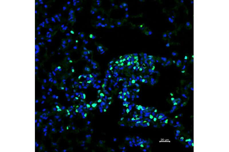 White blood cells that can help destroy malignant tumors