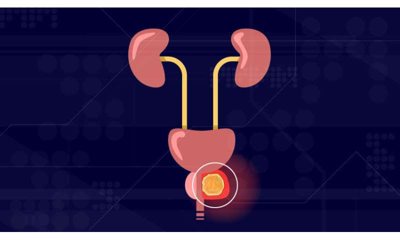 Toward a new staging system for prostate cancer, and why it matters