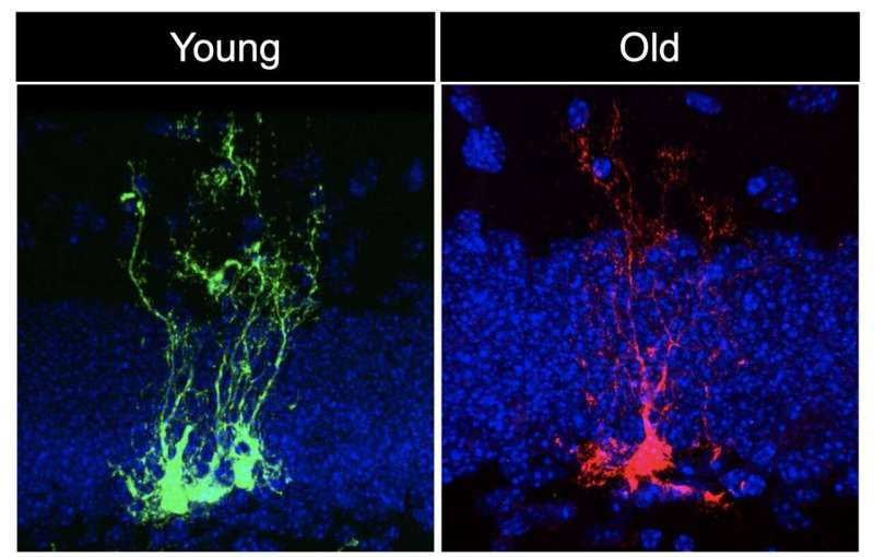 USC Stem Cell study reveals neural stem cells age rapidly