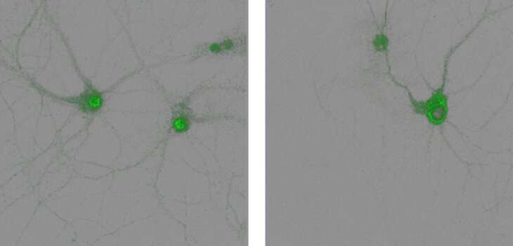 New mouse study reveals a key process in how the brain forms memories