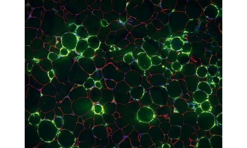 Blood vessel cells implicated in chronic inflammation of obesity