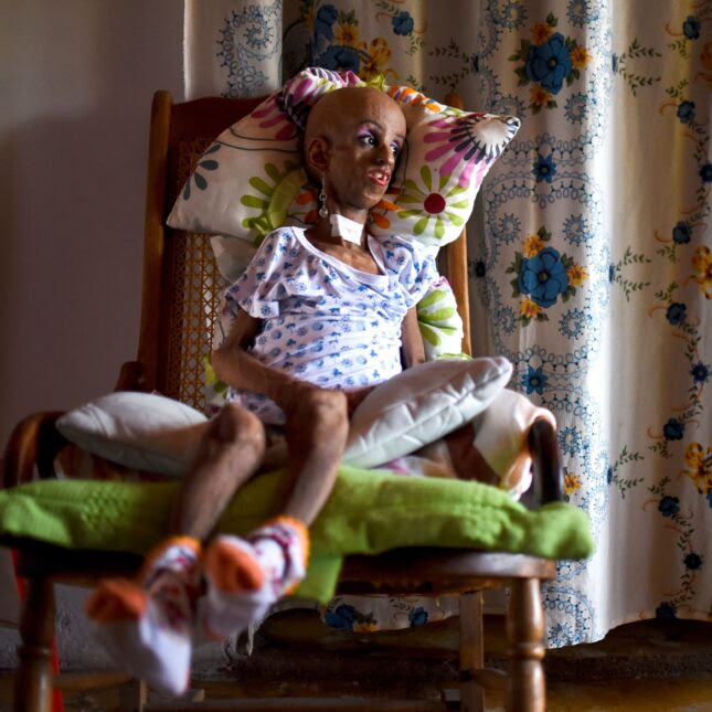 Progeria - Magali Gonzalez Sierra