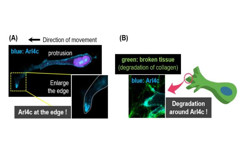 Researchers discover why pancreatic cancer cells are so aggressive