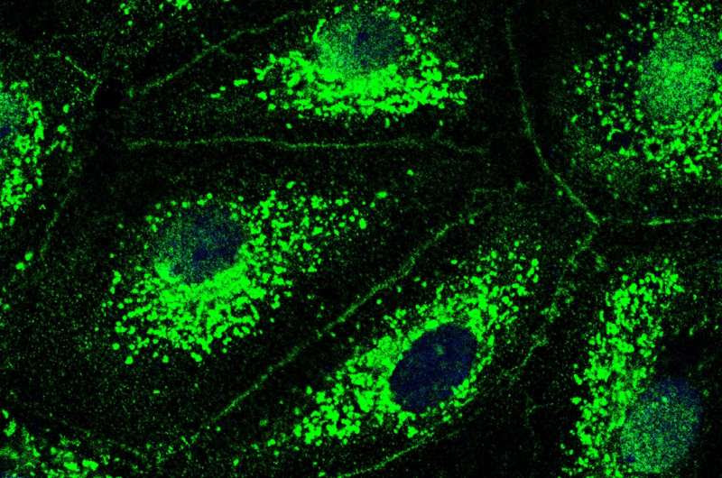 Cystic fibrosis drug could help treat pneumonia