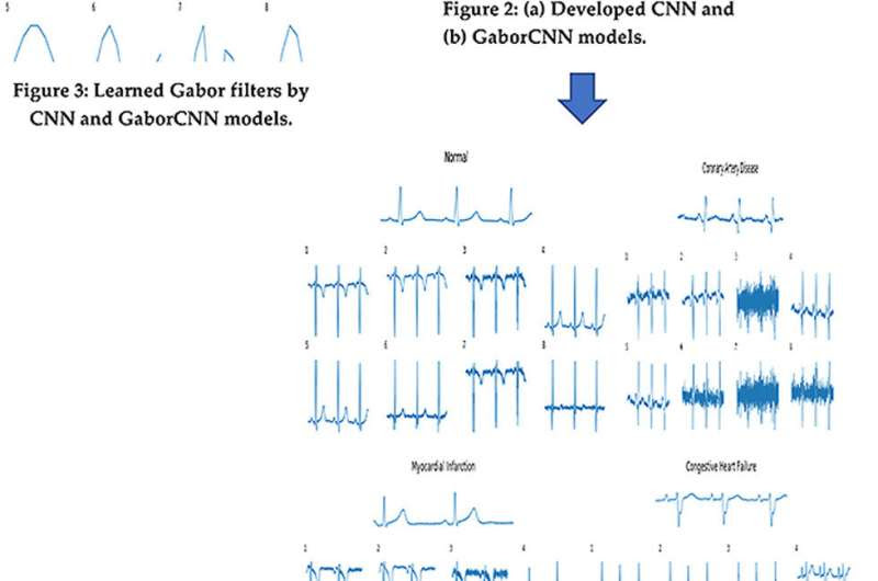 New artificial intelligence tool could speed up diagnosis of cardiovascular diseases