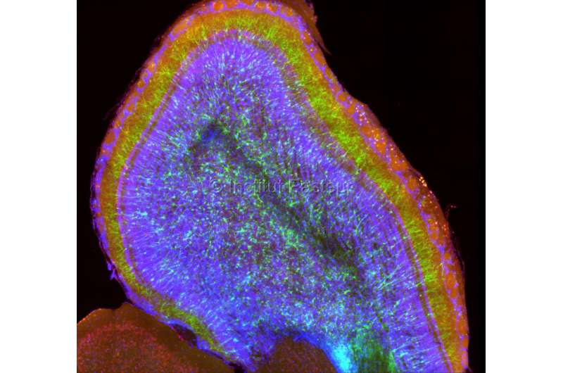 When severe infection causes long-term mood disorders: A promising avenue to prevent mental illness following a transient infect