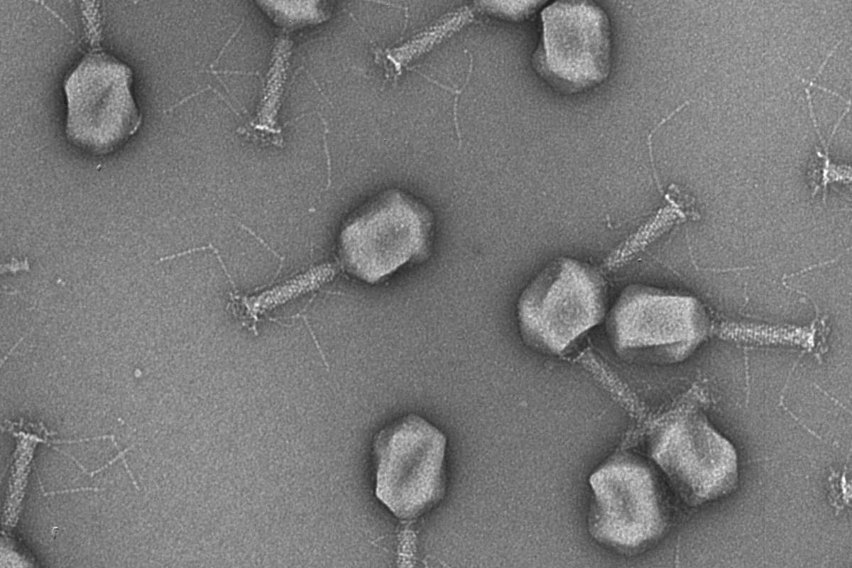 Bacteriophages seen under the microscope